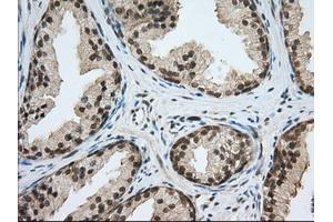 Immunohistochemical staining of paraffin-embedded Human liver tissue using anti-PDE4A mouse monoclonal antibody. (PDE4A 抗体)