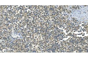 IHC analysis of IDH2 using anti-IDH2 antibody (ABIN7602786).