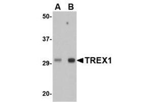 Image no. 1 for anti-three Prime Repair Exonuclease 1 (TREX1) (Internal Region) antibody (ABIN341718) (TREX1 抗体  (Internal Region))