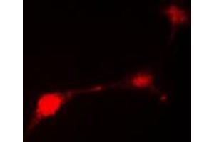 Immunofluorescent analysis of Parkin staining in HepG2 cells. (Parkin 抗体  (N-Term))