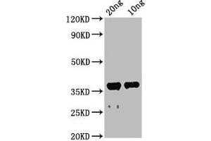 Western Blot Positive WB detected in Recombinant protein All lanes: ache antibody at 2. (Acetylcholinesterase 抗体  (AA 37-155))