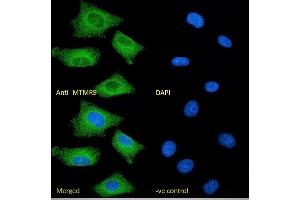 (ABIN184635) Immunofluorescence analysis of paraformaldehyde fixed A549 cells, permeabilized with 0. (MTMR9 抗体  (C-Term))