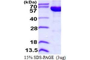 IMP (Inosine 5'-Monophosphate) Dehydrogenase 2 (IMPDH2) (AA 1-514) protein (His tag)
