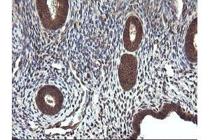 Image no. 5 for anti-Cancer/testis Antigen 1B (CTAG1B) antibody (ABIN1499895)
