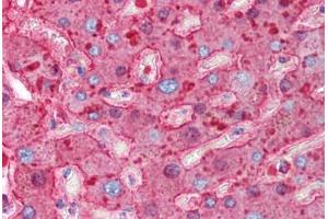 Human Liver (formalin-fixed, paraffin-embedded) stained with HP antibody ABIN214318 at 0. (Haptoglobin 抗体)