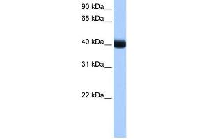 CK1 gamma 3 antibody used at 1 ug/ml to detect target protein. (CSNK1G3 抗体  (Middle Region))