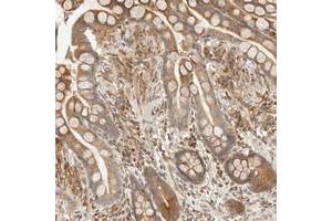 Immunohistochemical staining of human colon with TACC1 polyclonal antibody  shows moderate cytoplasmic positivity in glandular cells at 1:200-1:500 dilution. (TACC1 抗体)
