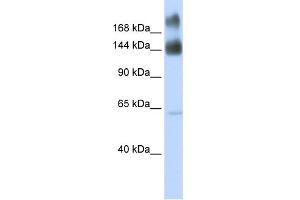 WB Suggested Anti-KTN1 Antibody Titration:  0. (KTN1 抗体  (Middle Region))