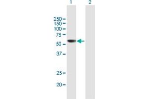 Western Blot analysis of PRAME expression in transfected 293T cell line by PRAME MaxPab polyclonal antibody. (PRAME 抗体  (AA 1-509))