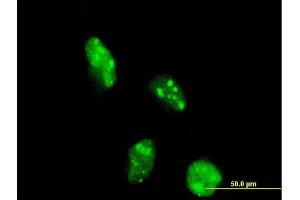 Immunofluorescence of monoclonal antibody to DOT1L on HeLa cell. (DOT1L 抗体  (AA 3-108))