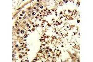 IHC analysis of FFPE human testis tissue stained with TBP antibody (TBP 抗体  (AA 210-239))