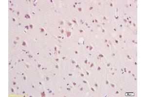 Formalin-fixed and paraffin embedded rat brain labeled with Rabbit Anti IFNAR2/IFNABR Polyclonal Antibody, Unconjugated  at 1:200 followed by conjugation to the secondary antibody and DAB staining