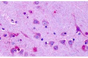 Anti-OR6N1 antibody IHC staining of human brain, cortex, neurons.