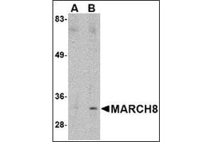 Western blot analysis of MARCH8 in HeLa cell lysate with this product at (A) 0. (MARCH8 抗体  (C-Term))