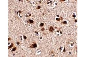 Immunohistochemistry (IHC) image for anti-SLIT and NTRK-Like Family, Member 5 (SLITRK5) (Middle Region 1) antibody (ABIN1031190) (SLITRK5 抗体  (Middle Region 1))