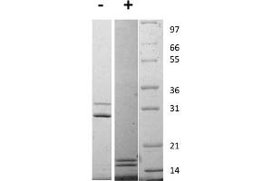 SDS-PAGE of Rat Interleukin-17AF Heterodimer Recombinant Protein SDS-PAGE of Rat Interleukin-17 Animal Free Recombinant Protein.