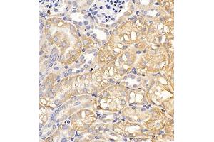 Immunohistochemistry of paraffin embedded mouse kidney using Clcn5 (ABIN7073471) at dilution of 1:200 (400x lens) (Chloride Channel 5 抗体)