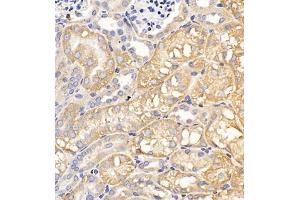 Immunohistochemistry of paraffin embedded mouse kidney using Clcn5 (ABIN7073471) at dilution of 1:200 (400x lens) (Chloride Channel 5 抗体)