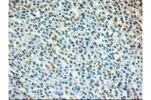 Image no. 1 for anti-Myc Proto-Oncogene protein (MYC) antibody (ABIN1497011)