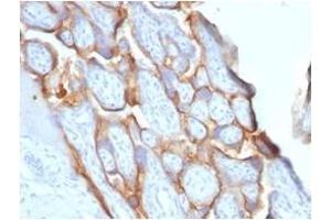 Formalin-fixed, paraffin-embedded human placenta stained with HCG-beta Rabbit Recombinant Monoclonal Antibody (HCGb/1996R). (Recombinant CGB 抗体)