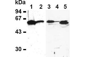 Western Blotting (WB) image for anti-E2F Transcription Factor 4, P107/p130-Binding (E2F4) antibody (ABIN487490) (E2F4 抗体)