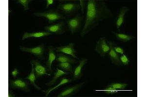 Immunofluorescence of purified MaxPab antibody to MAP3K14 on HeLa cell. (MAP3K14 抗体  (AA 1-947))