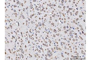 IHC analysis of RPL11 using anti-RPL11 antibody (ABIN7602315). (RPL11 抗体  (AA 7-178))
