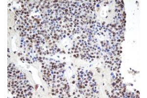 Image no. 4 for anti-Apurinic/Apyrimidinic Endonuclease 1 (APEX1) (AA 1-242) antibody (ABIN1490625) (APEX1 抗体  (AA 1-242))