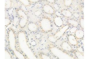 ABIN6258203 and ABIN6273889 at 1/100 staining human normal kidney tissue by IHC-P. (GPR68 抗体  (Internal Region))