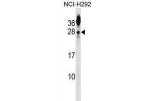 TSPAN2 Antibody (N-term) western blot analysis in NCI-H292 cell line lysates (35 µg/lane). (Tetraspanin 2 抗体  (N-Term))