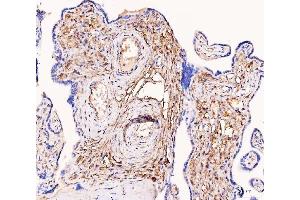 IHC analysis of Tissue Factor using anti-Tissue Factor antibody (ABIN3042382).