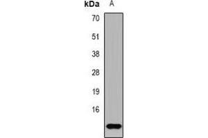 Western blot analysis of TF2A2 expression in NCIH460 (A) whole cell lysates. (GTF2A2 抗体)
