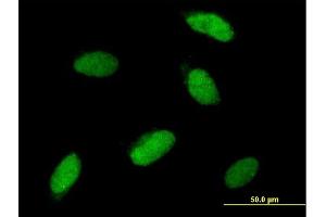 Immunofluorescence of purified MaxPab antibody to SNAI1 on HeLa cell. (SNAIL 抗体  (AA 1-264))