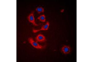 Immunofluorescent analysis of Calreticulin staining in HeLa cells.