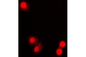 Immunofluorescent analysis of PML staining in COLO320 cells. (PML 抗体  (N-Term))