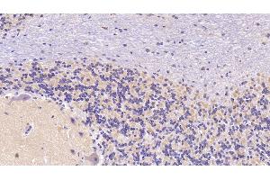 Immunohistochemistry (IHC) image for anti-Sema Domain, Seven Thrombospondin Repeats (Type 1 and Type 1-Like), Transmembrane Domain (TM) and Short Cytoplasmic Domain, (Semaphorin) 5B (SEMA5B) (AA 36-161) antibody (ABIN7438253)
