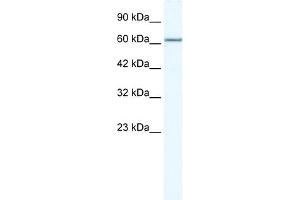 WB Suggested Anti-MCM5 Antibody Titration:  2. (MCM5 抗体  (N-Term))