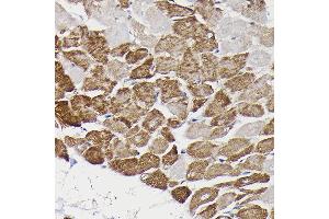 Immunohistochemistry (IHC) image for anti-Monoamine Oxidase B (MAOB) (AA 1-260) antibody (ABIN3022152)