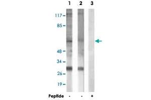 Western blot analysis of extracts from HepG2 cells (Lane 1) and COLO 205 cells (Lane 2 and 3), using MITF polyclonal antibody . (MITF 抗体  (Ser73, Ser180))