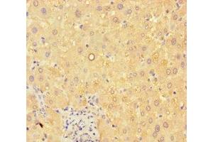 Immunohistochemistry of paraffin-embedded human liver tissue using ABIN7144096 at dilution of 1:100 (C19ORF80 抗体  (AA 22-198))