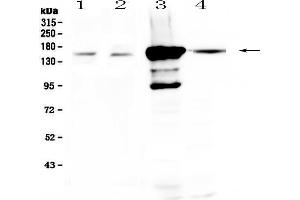 Western blot analysis of PRX using anti-PRX antibody . (Periaxin 抗体  (AA 1-91))
