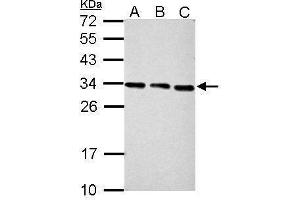 WB Image Sample (30 ug of whole cell lysate) A: NIH-3T3 B: JC C: BCL-1 12% SDS PAGE antibody diluted at 1:2000 (PSME3 抗体)
