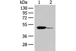 Western blot analysis of Mouse heart tissue and K562 cell lysates using ACOD1 Polyclonal Antibody at dilution of 1:400 (IRG1 抗体)