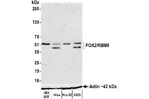 Western Blotting (WB) image for anti-RNA Binding Motif Protein 9 (RBM9) (AA 1-50) antibody (ABIN7454009) (Recombinant RBM9 抗体  (AA 1-50))