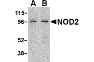 Image no. 2 for anti-Nucleotide-Binding Oligomerization Domain Containing 2 (NOD2) (C-Term) antibody (ABIN372922) (NOD2 抗体  (C-Term))