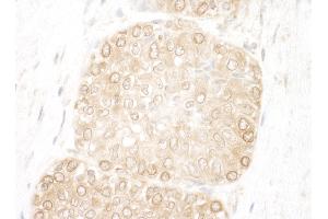 Immunohistochemistry (IHC) image for anti-WD Repeat and FYVE Domain Containing 3 (WDFY3) (AA 500-550) antibody (ABIN7448861)