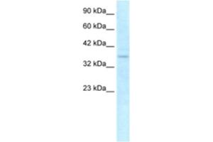 Western Blotting (WB) image for anti-NLR Family, CARD Domain Containing 4 (NLRC4) antibody (ABIN2463643) (NLRC4 抗体)