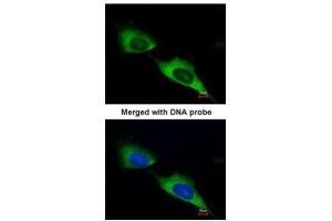 ICC/IF Image Immunofluorescence analysis of paraformaldehyde-fixed HeLa, using MTMR9, antibody at 1:200 dilution. (MTMR9 抗体  (C-Term))