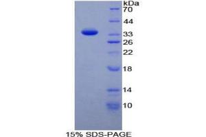 SDS-PAGE analysis of Human TAF1 Protein.