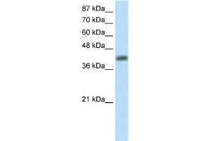 WB Suggested Anti-APTX Antibody Titration:  2. (Aprataxin 抗体  (C-Term))
